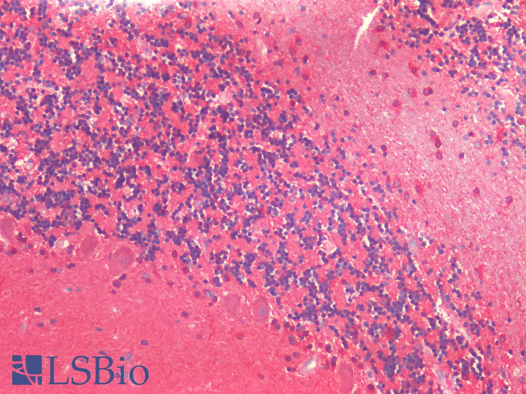 PathPlus™ UCHL1 / PGP9.5 Antibody