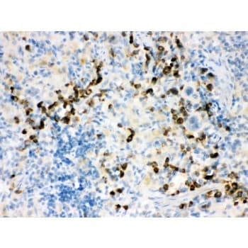 ACTA1 / Skeletal Muscle Actin Antibody (aa359-377)