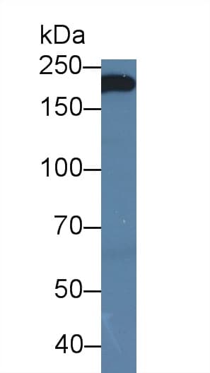 CTNNB1 / Beta Catenin Antibody (PE)