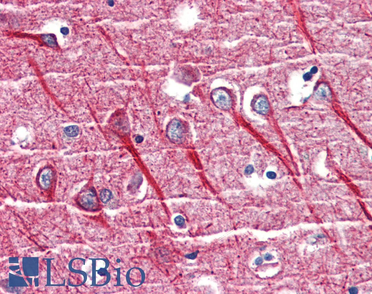 IHC-plus™ Polyclonal Rabbit anti-Mouse TNFRSF1A / TNFR1 Antibody (IHC, WB)