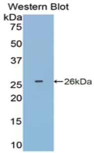 GSTP1 / GST Pi Antibody (aa1-210)
