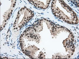 ERCC1 Antibody (clone OTI1C6)