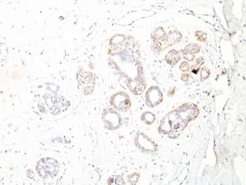 SMMHC / MYH11 Antibody (clone ID8)