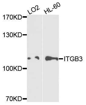 ITGB3 / Integrin Beta 3 / CD61 Antibody