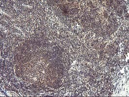 PDLIM2 / SLIM Antibody (clone OTI3B5)