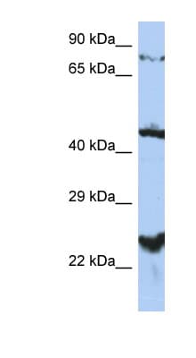 HPT / MRS2L Antibody (aa215-264)