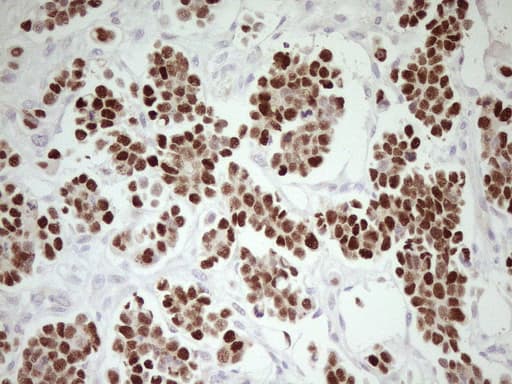 TP53 / p53 Antibody (clone UMAB206)