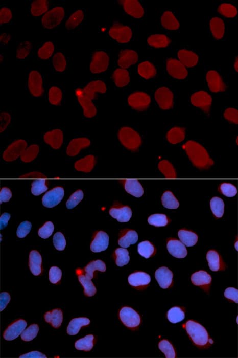 LMNB1 / Lamin B1 Antibody