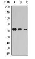 Polyclonal Rabbit anti-Human COIL / Coilin Antibody (IF, WB)