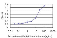 Monoclonal Mouse anti-Human BABP / AKR1C2 Antibody (clone 3C11, WB)