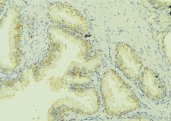 Polyclonal Rabbit anti-Human CCL13 / MCP4 Antibody (IHC, WB)