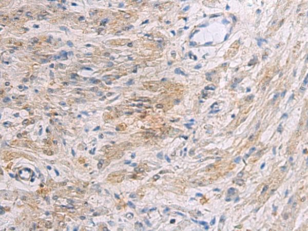 SLC30A3 / ZNT3 Antibody