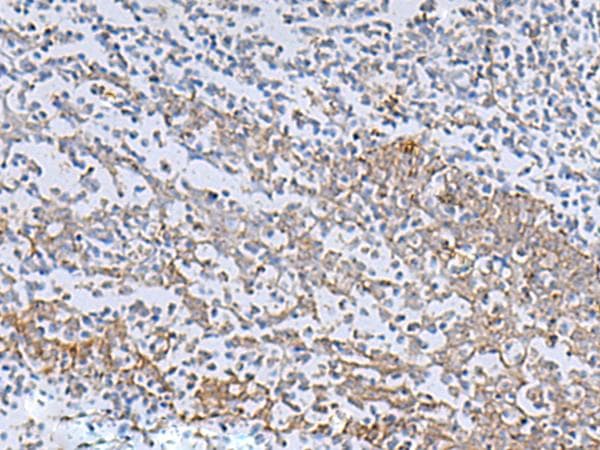 Polyclonal Rabbit anti-Human IL-22BP / IL22RA2 Antibody (IHC)