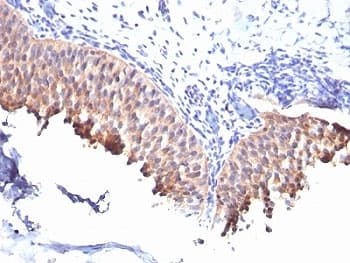 Monoclonal Mouse anti-Human KRT10 / CK10 / Cytokeratin 10 Antibody (clone SPM261, IHC, IF)