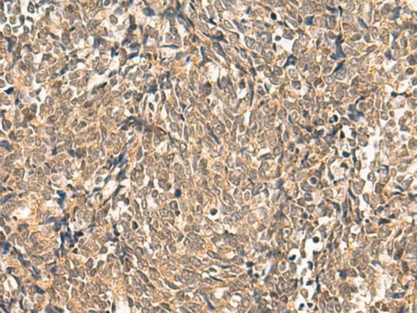 Polyclonal Rabbit anti-Human HNF1A / HNF1 Antibody (IHC)