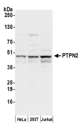 PTPN2 / TC-PTP Antibody (aa1-50)