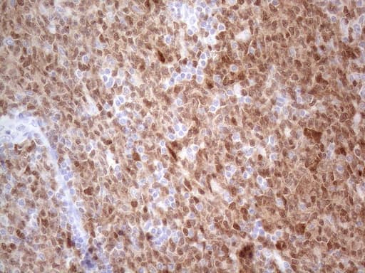 Monoclonal Mouse anti-Human POU2AF1 / BOB1 Antibody (clone OTI2D4, IHC, WB)