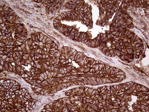IQGAP1 Antibody (aa464-609, clone OTI5F9, Carrier-free)