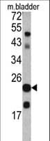 TAGLN / Transgelin / SM22 Antibody (aa139-167)