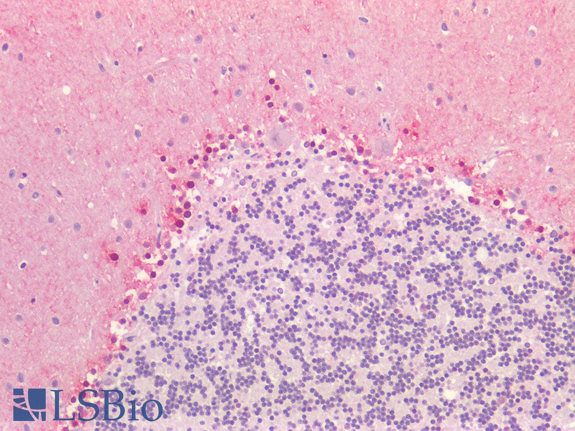 PathPlus™ ACVRL1 Antibody (aa196-245)