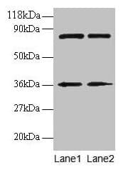 Polyclonal Rabbit anti-Human HNRNPH1 / hnRNP H Antibody (IHC, WB)