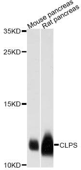 CLPS / Colipase Antibody