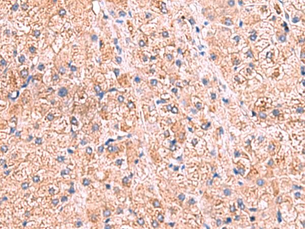 Polyclonal Rabbit anti-Human ZNF256 Antibody (IHC)