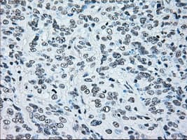 BRAF / B-Raf Antibody (clone OTI4C11)