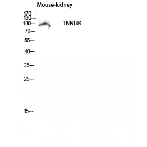 Polyclonal Rabbit anti-Human TNNI3K / CARK Antibody (270-350 aa, Internal, IHC, WB)