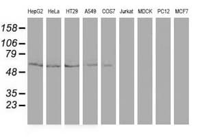 DTNA / Dystrobrevin Alpha Antibody (clone OTI2F9)