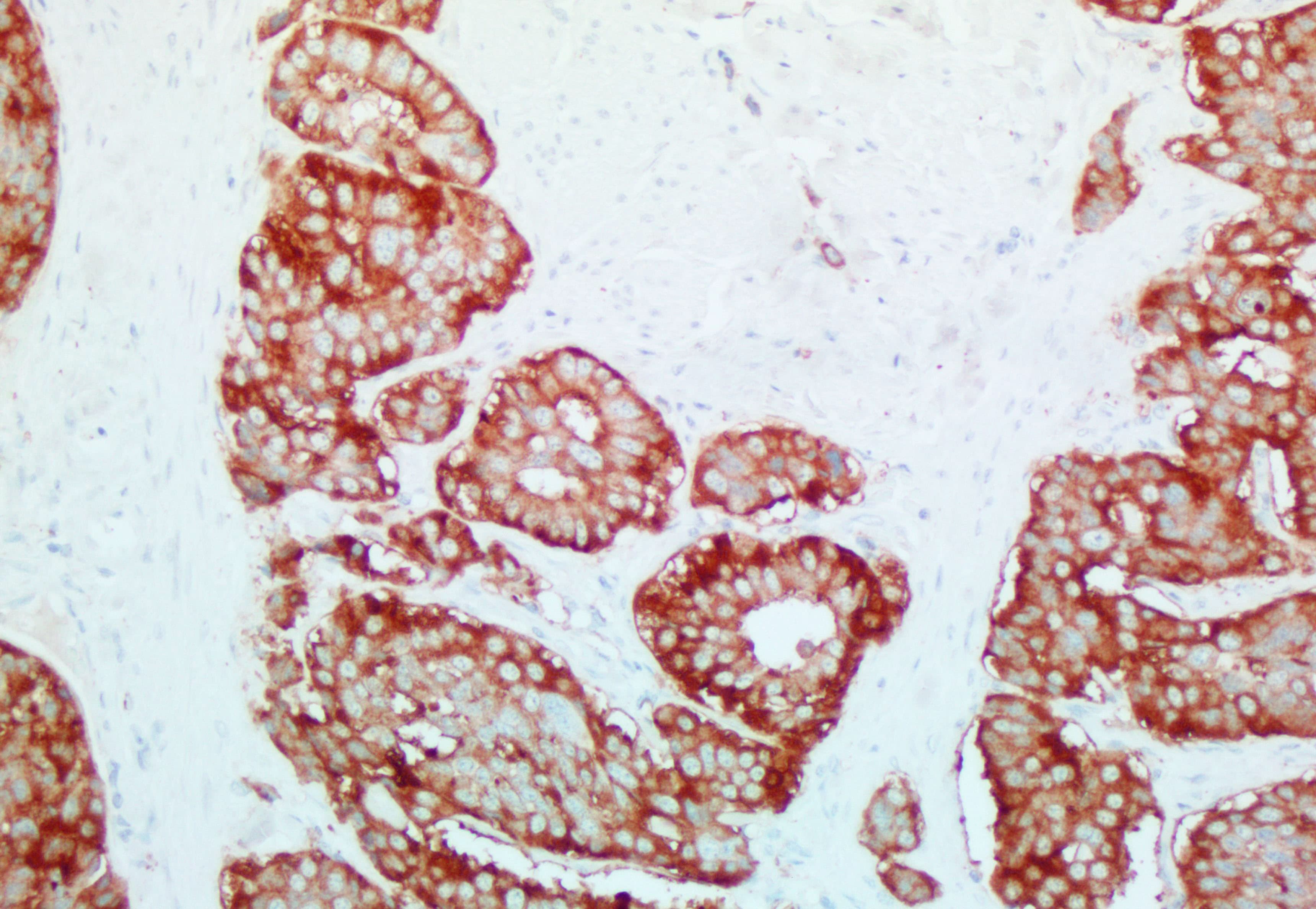 SYP / Synaptophysin Antibody (clone UMAB112)