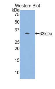 FKBP10 / FKBP65 Antibody (aa158-440)