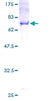 Human CNPase Protein (Recombinant GST)
