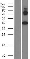 PRICKLE4 Protein (Over-Expression Lysate Myc-DDK (Flag))