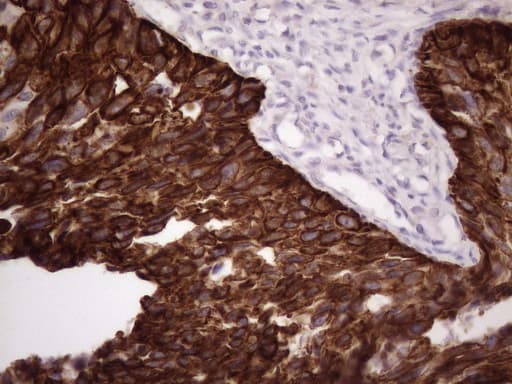KRT16 / CK16 / Cytokeratin 16 Antibody (clone OTI1G5)