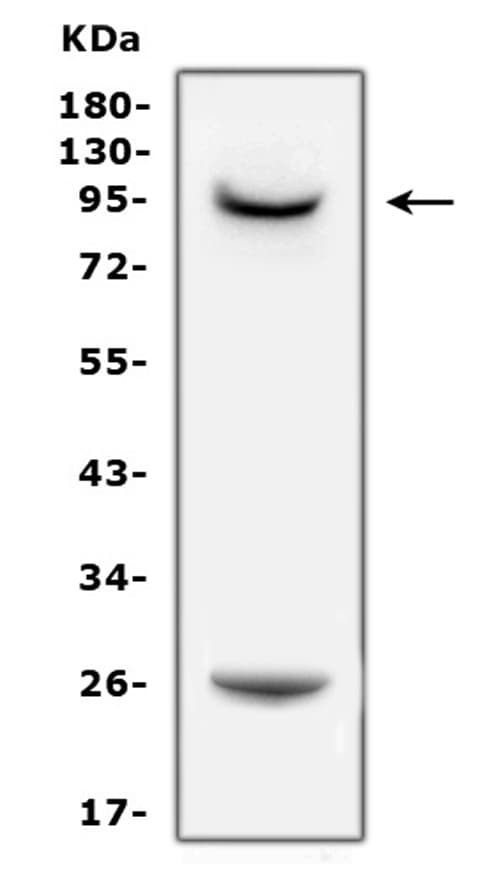 PRLR / Prolactin Receptor Antibody (aa591-605)