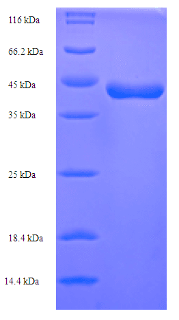 Schistosoma mansoni Major Egg Antigen Protein (Recombinant 6His, N-terminus)