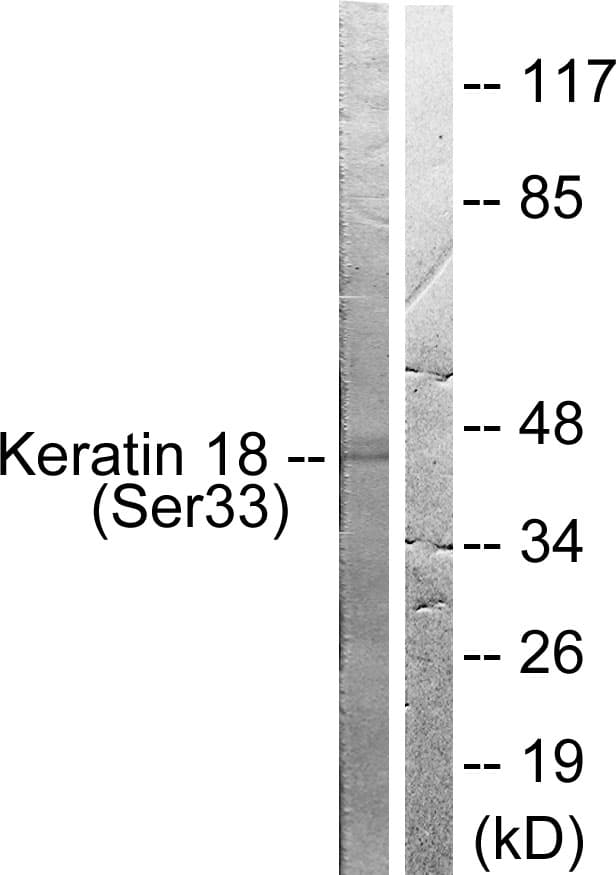 KRT18 / CK18 / Cytokeratin 18 Antibody (phospho-Ser33)