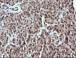 MAP2K1 / MKK1 / MEK1 Antibody (clone OTI2F1)
