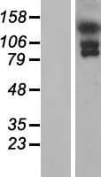 EFCAB6 Protein (Over-Expression Lysate Myc-DDK (Flag))