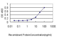 IHC-plus™ RBBP4 / RBAP48 Antibody (clone 2D7)