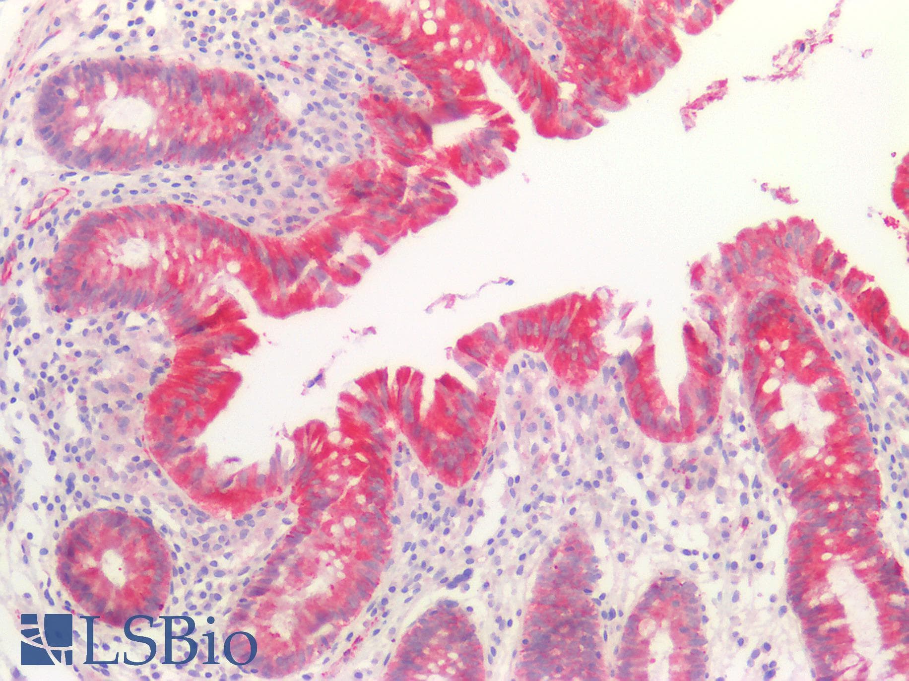 PathPlus™ SMAD3 Antibody