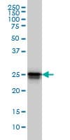 IHC-plus™ HMG1 / HMGB1 Antibody (clone 2F6)