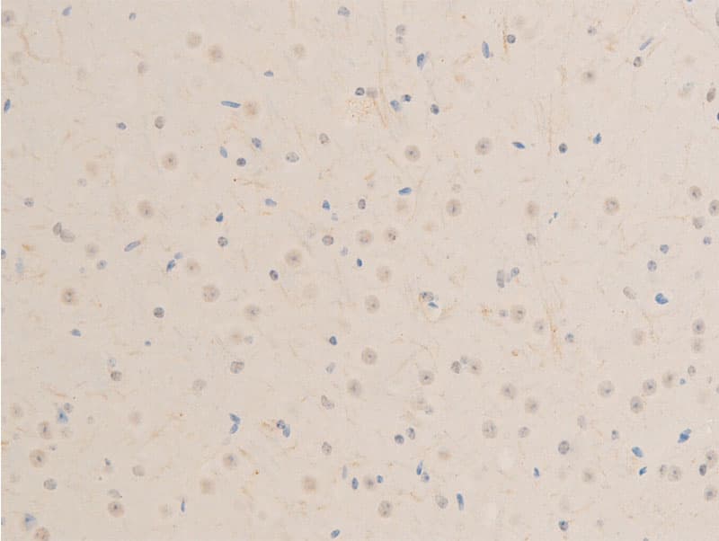 Polyclonal Rabbit anti-Human MITF Antibody (phospho-Ser180,phospho-Ser73, IHC, IF, WB)
