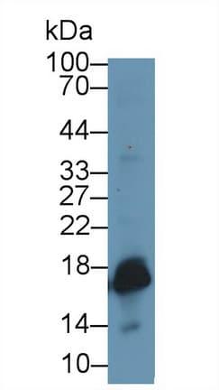 SOD1 / Cu-Zn SOD Antibody (aa2-154)