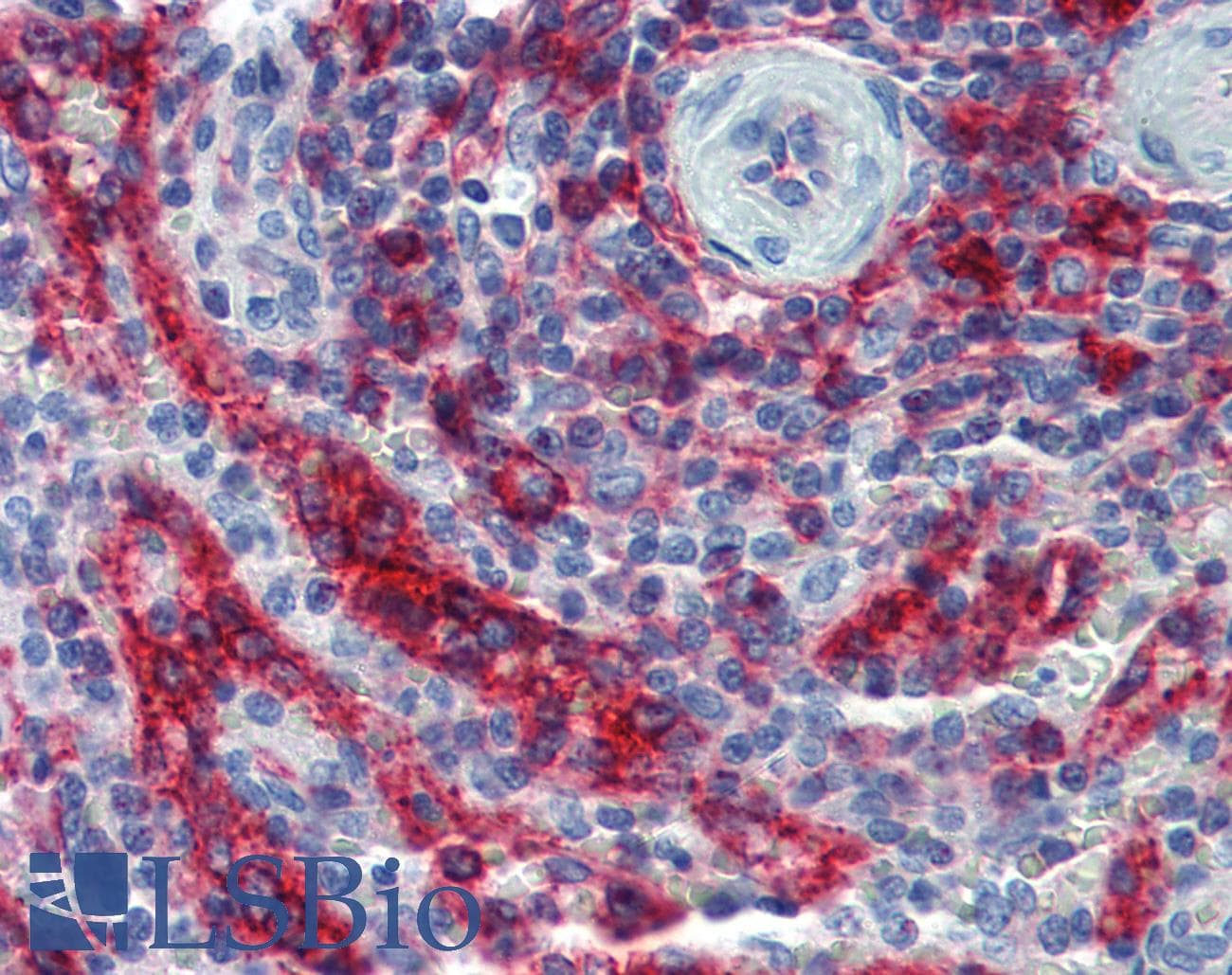 IHC-plus™ HLA-E Antibody (clone MEM-E/06)