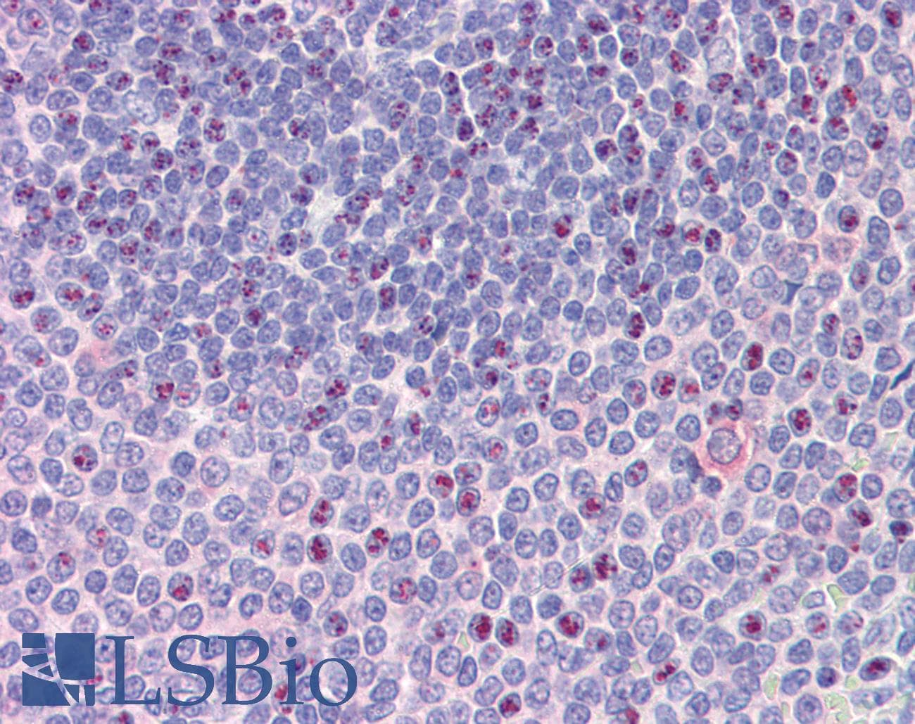 IHC-plus™ Polyclonal Goat anti-Human NCOA3 / SRC-3 / AIB1 Antibody (aa188-198, IHC)