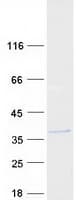 Human C11orf46 Protein (Recombinant Myc-DDK (Flag))