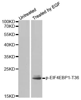 Polyclonal Rabbit anti-Human EIF4EBP1 / 4EBP1 Antibody (phospho-Thr36, IHC, WB)