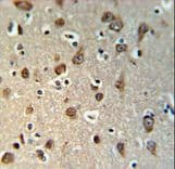 Polyclonal Rabbit anti-Human YME1L1 Antibody (aa191-219, IHC, WB)